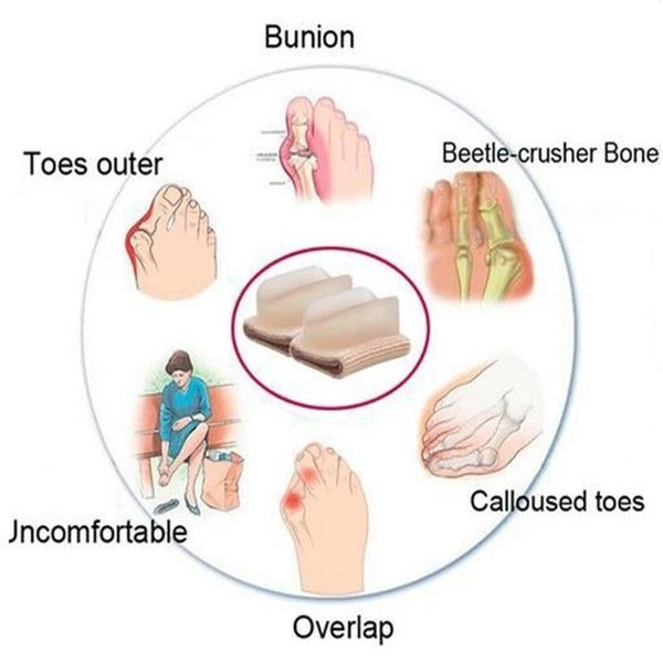 Hallux valgus orthosis